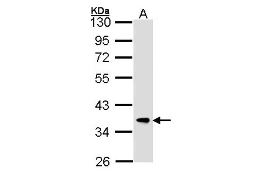FBXL12 antibody from Signalway Antibody (22707) - Antibodies.com