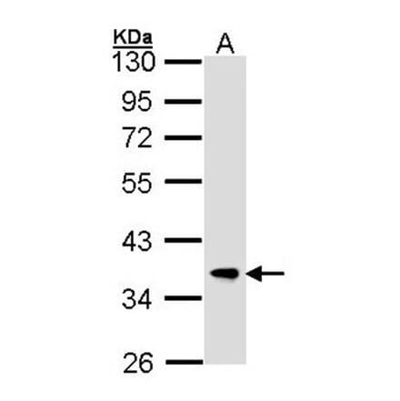 FBXL12 antibody from Signalway Antibody (22707) - Antibodies.com