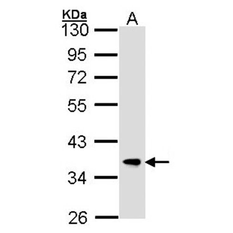 FBXL12 antibody from Signalway Antibody (22707) - Antibodies.com