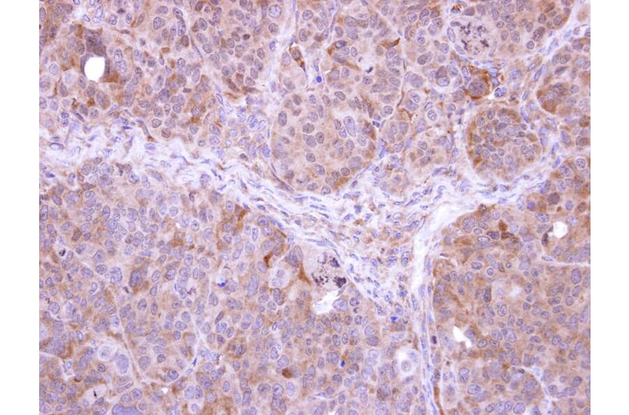 Immunohistochemistry - FBXL12 antibody from Signalway Antibody (22707) - Antibodies.com