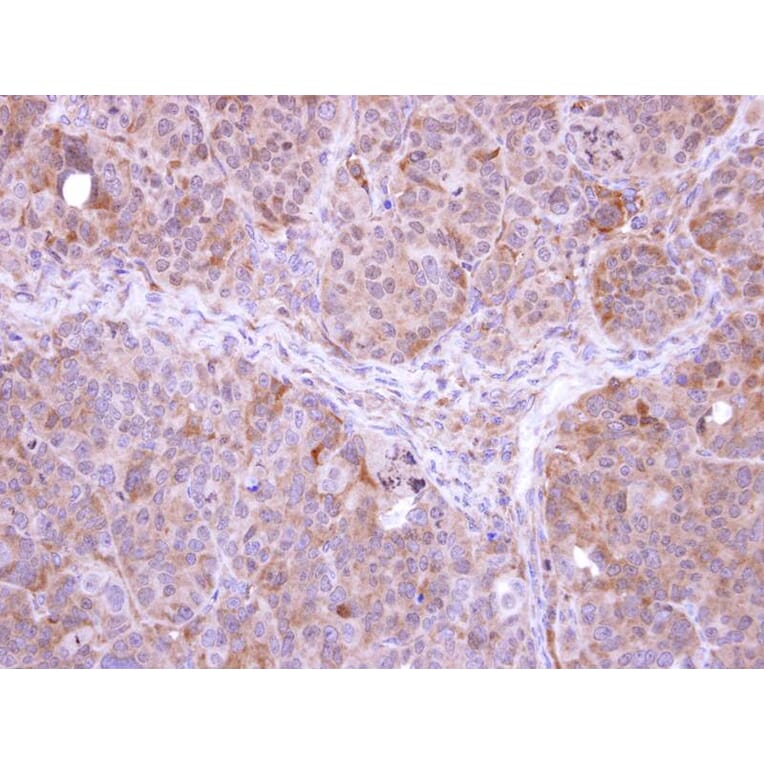 Immunohistochemistry - FBXL12 antibody from Signalway Antibody (22707) - Antibodies.com