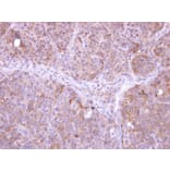 Immunohistochemistry - FBXL12 antibody from Signalway Antibody (22707) - Antibodies.com
