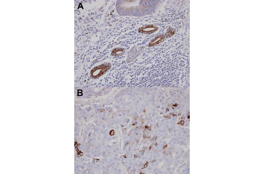 Immunohistochemistry - AKAP10 antibody from Signalway Antibody (22770) - Antibodies.com