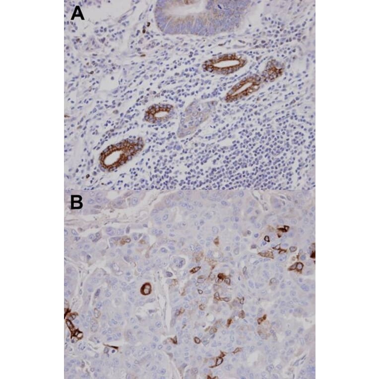 Immunohistochemistry - AKAP10 antibody from Signalway Antibody (22770) - Antibodies.com