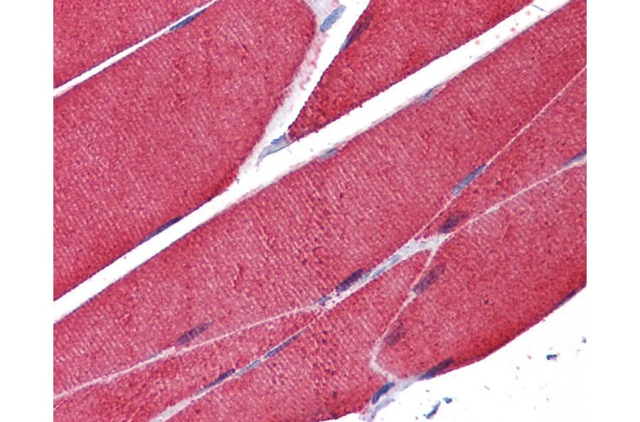 Immunohistochemistry - Actin antibody from Signalway Antibody (22954) - Antibodies.com