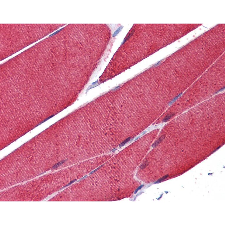 Immunohistochemistry - Actin antibody from Signalway Antibody (22954) - Antibodies.com