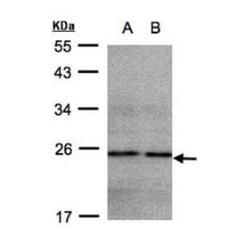 NDUFB9 antibody from Signalway Antibody (23044) - Antibodies.com