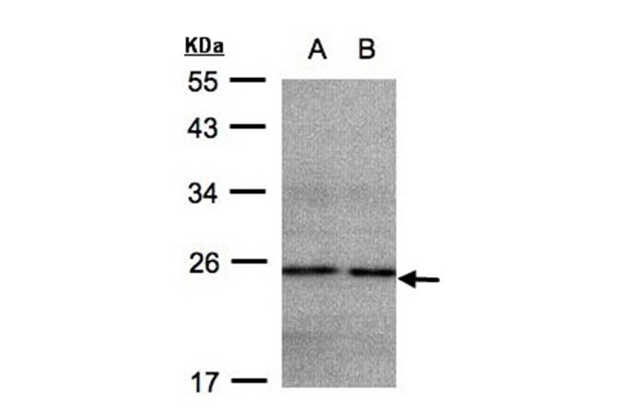 NDUFB9 antibody from Signalway Antibody (23044) - Antibodies.com