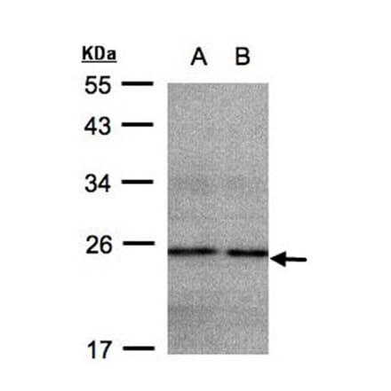 NDUFB9 antibody from Signalway Antibody (23044) - Antibodies.com