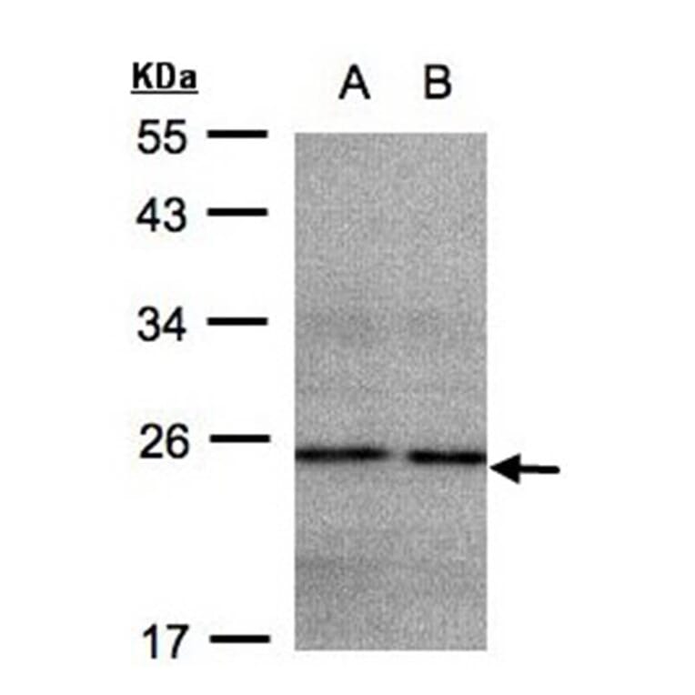 NDUFB9 antibody from Signalway Antibody (23044) - Antibodies.com