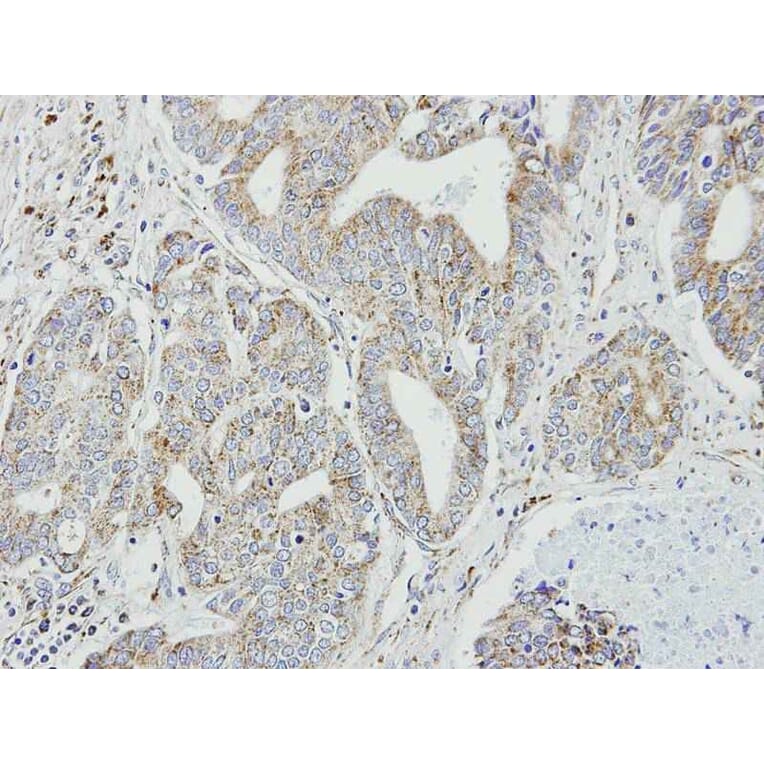 Immunohistochemistry - NDUFB9 antibody from Signalway Antibody (23044) - Antibodies.com