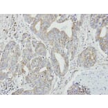 Immunohistochemistry - NDUFB9 antibody from Signalway Antibody (23044) - Antibodies.com