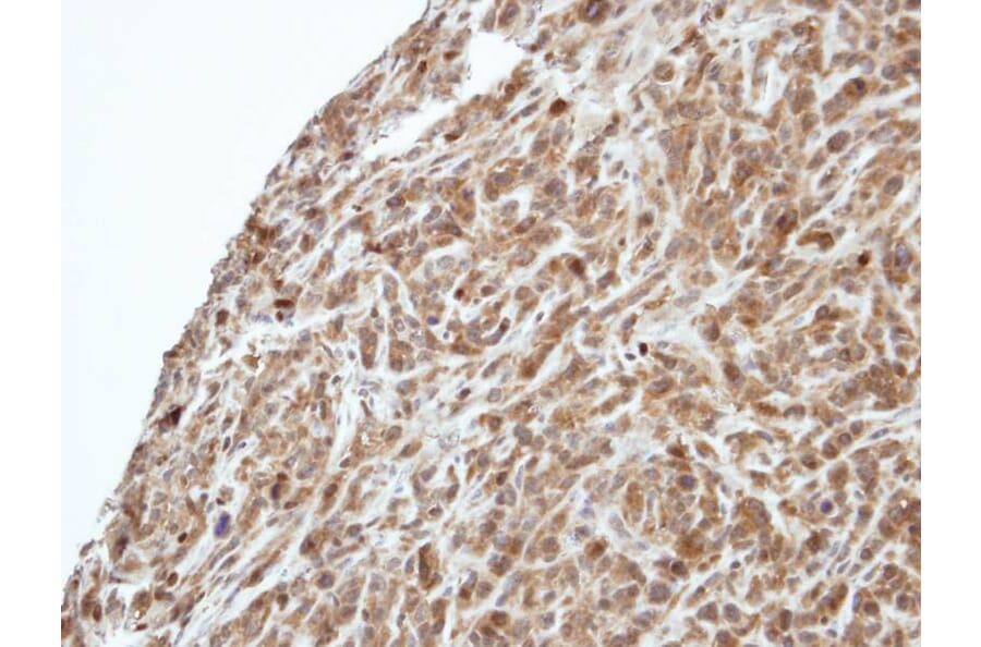 Immunohistochemistry - PIK3R3 antibody from Signalway Antibody (23086) - Antibodies.com
