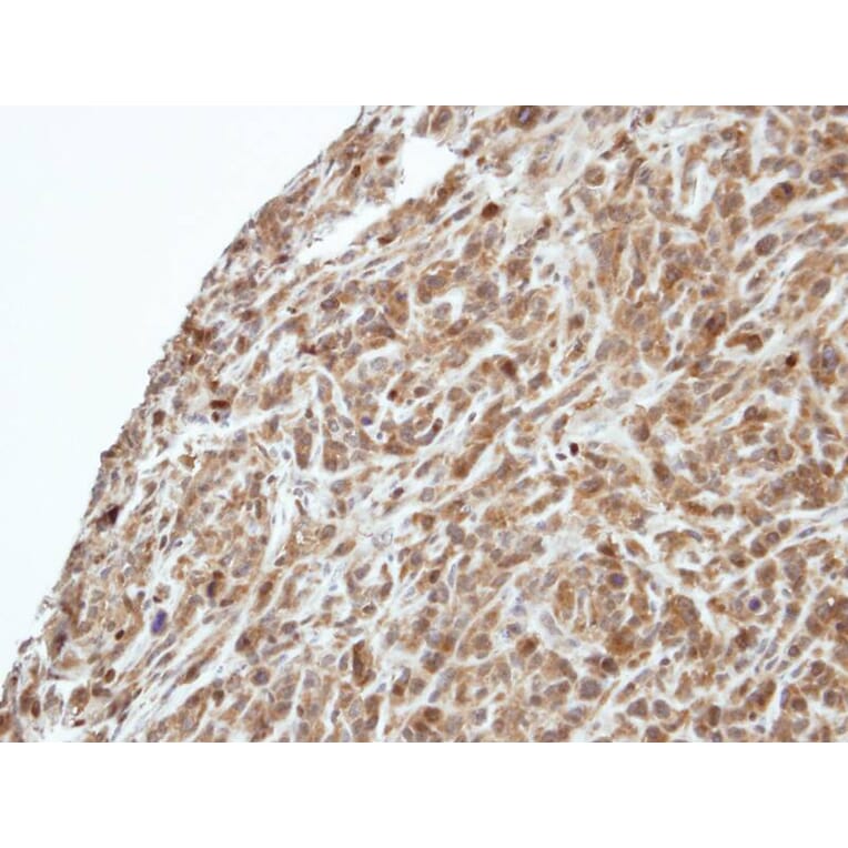 Immunohistochemistry - PIK3R3 antibody from Signalway Antibody (23086) - Antibodies.com