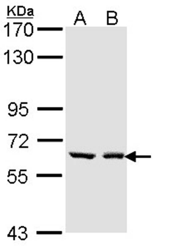 Sample (30 µg of whole cell lysate)  A431 B: H1299 7.5% SDS PAGE Primary antibody diluted at 1: 1000