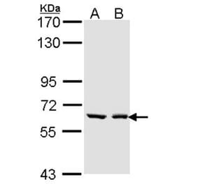 UGT1A6 antibody from Signalway Antibody (23131) - Antibodies.com