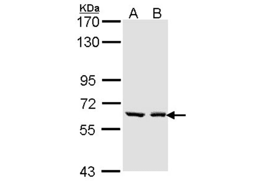 UGT1A6 antibody from Signalway Antibody (23131) - Antibodies.com