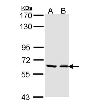 UGT1A6 antibody from Signalway Antibody (23131) - Antibodies.com