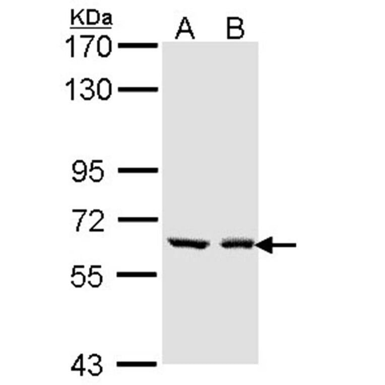 UGT1A6 antibody from Signalway Antibody (23131) - Antibodies.com