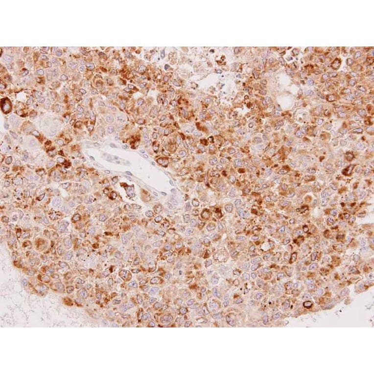Immunohistochemistry - UGT1A6 antibody from Signalway Antibody (23131) - Antibodies.com