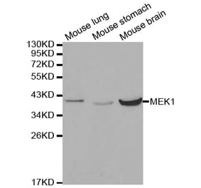 Western blot - MAP2K1 Antibody from Signalway Antibody (32044) - Antibodies.com