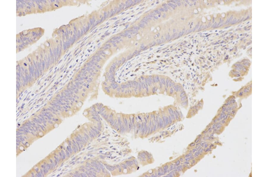 Immunohistochemistry - MAP2K1 Antibody from Signalway Antibody (32044) - Antibodies.com