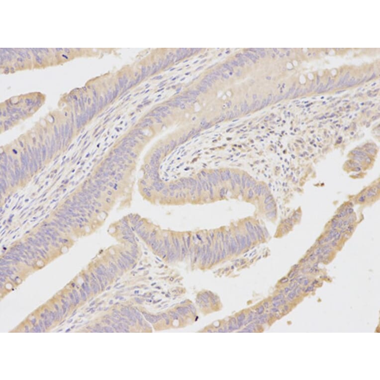 Immunohistochemistry - MAP2K1 Antibody from Signalway Antibody (32044) - Antibodies.com