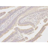 Immunohistochemistry - MAP2K1 Antibody from Signalway Antibody (32044) - Antibodies.com
