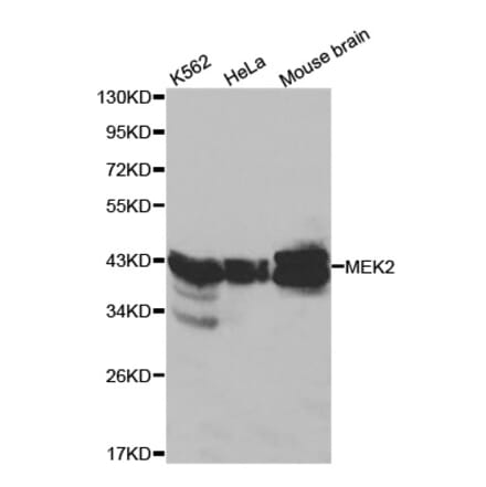 Western blot - MAP2K2 Antibody from Signalway Antibody (32045) - Antibodies.com
