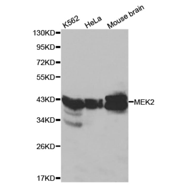 Western blot - MAP2K2 Antibody from Signalway Antibody (32045) - Antibodies.com