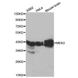Western blot - MAP2K2 Antibody from Signalway Antibody (32045) - Antibodies.com