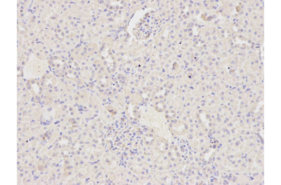 Immunohistochemistry - MAP2K2 Antibody from Signalway Antibody (32045) - Antibodies.com