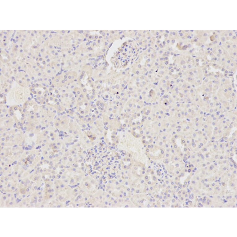 Immunohistochemistry - MAP2K2 Antibody from Signalway Antibody (32045) - Antibodies.com
