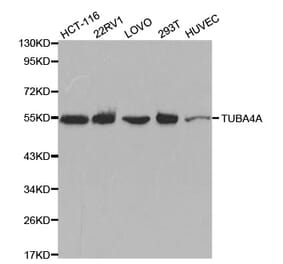 Western blot - TUBA4A Antibody from Signalway Antibody (32061) - Antibodies.com