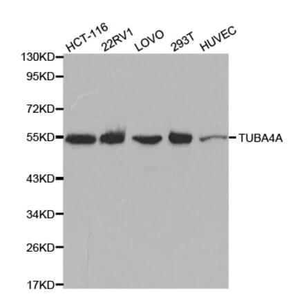 Western blot - TUBA4A Antibody from Signalway Antibody (32061) - Antibodies.com