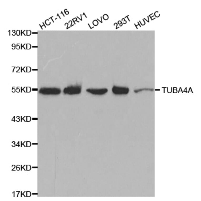 Western blot - TUBA4A Antibody from Signalway Antibody (32061) - Antibodies.com