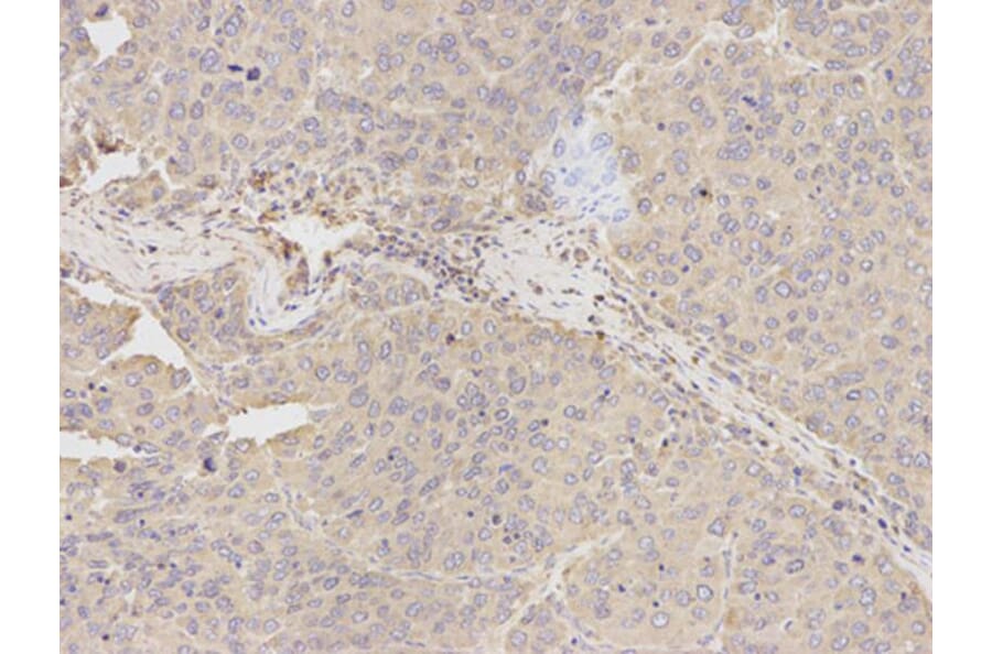 Immunohistochemistry - TUBA4A Antibody from Signalway Antibody (32061) - Antibodies.com