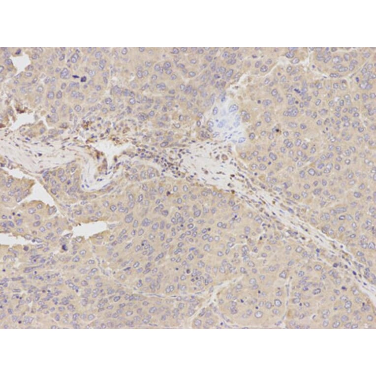 Immunohistochemistry - TUBA4A Antibody from Signalway Antibody (32061) - Antibodies.com