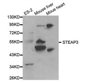Western blot - STEAP3 Antibody from Signalway Antibody (32080) - Antibodies.com