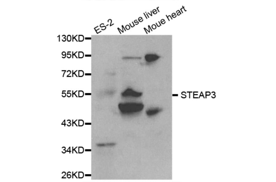 Western blot - STEAP3 Antibody from Signalway Antibody (32080) - Antibodies.com