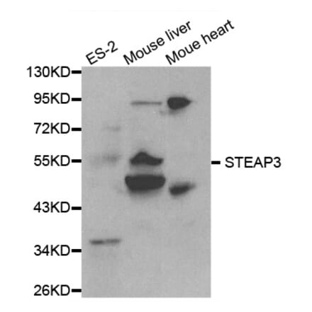 Western blot - STEAP3 Antibody from Signalway Antibody (32080) - Antibodies.com
