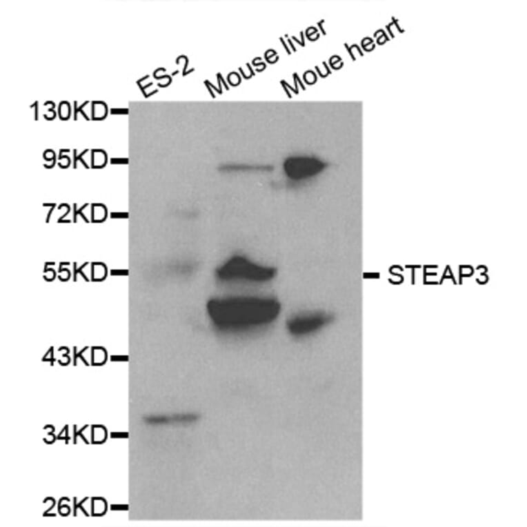 Western blot - STEAP3 Antibody from Signalway Antibody (32080) - Antibodies.com