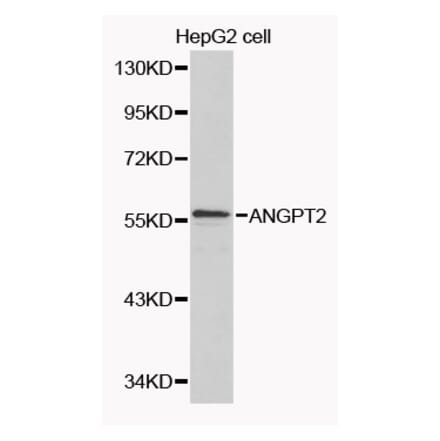 Western blot - ANGPT2 Antibody from Signalway Antibody (32088) - Antibodies.com