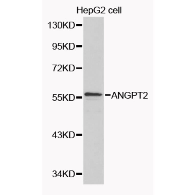 Western blot - ANGPT2 Antibody from Signalway Antibody (32088) - Antibodies.com