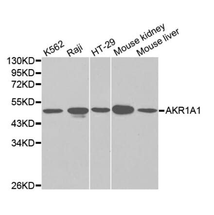 Western blot - AKR1A1 Antibody from Signalway Antibody (32142) - Antibodies.com