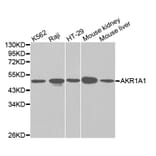 Western blot - AKR1A1 Antibody from Signalway Antibody (32142) - Antibodies.com