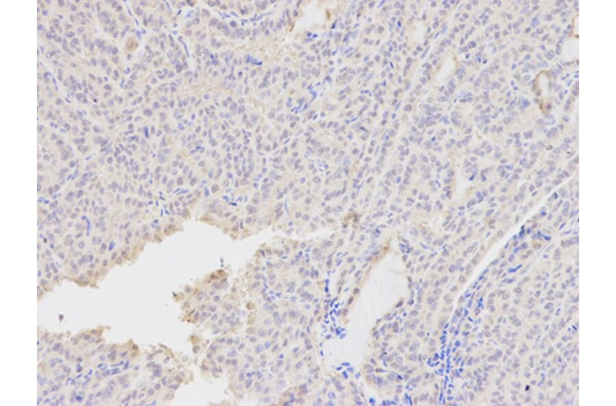 Immunohistochemistry - AKR1A1 Antibody from Signalway Antibody (32142) - Antibodies.com