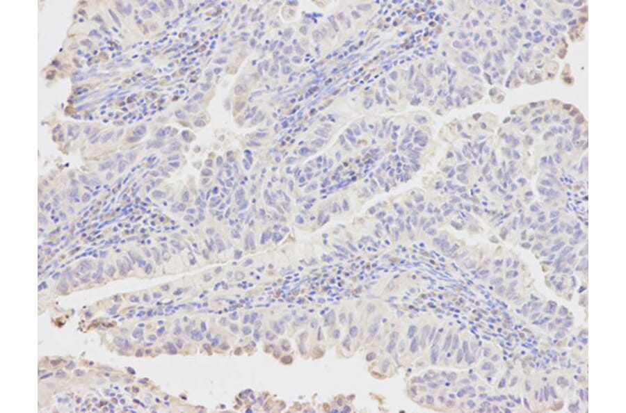 Immunohistochemistry - AKR1A1 Antibody from Signalway Antibody (32142) - Antibodies.com