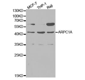 Western blot - ARPC1A Antibody from Signalway Antibody (32144) - Antibodies.com