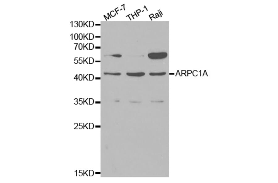 Western blot - ARPC1A Antibody from Signalway Antibody (32144) - Antibodies.com